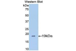 Detection of Recombinant CYPA, Mouse using Polyclonal Antibody to Cyclophilin A (CYPA) (PPIA 抗体  (AA 2-164))