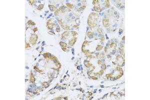 Immunohistochemistry of paraffin-embedded human stomach using PRK antibody (ABIN6132517, ABIN6146187, ABIN6146188 and ABIN6223135) at dilution of 1:100 (40x lens). (PRKAG1 抗体  (AA 1-331))