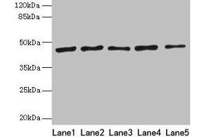 Western blot All lanes: RRM2 antibody at 8 μg/mL Lane 1: HepG2 whole cell lysate Lane 2: Jurkat whole cell lysate Lane 3: Hela whole cell lysate Lane 4: K562 whole cell lysate Lane 5: 293T whole cell lysate Secondary Goat polyclonal to rabbit IgG at 1/10000 dilution Predicted band size: 45, 52 kDa Observed band size: 45 kDa (RRM2 抗体  (AA 1-389))
