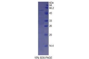 SDS-PAGE analysis of Human Spondin 2 Protein. (SPON2 蛋白)