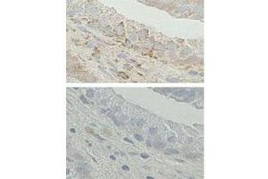 IHC analysis of FFPE human prostate tissue. (Endoplasmic Reticulum Amyloid Binding Protein (ERAB) (AA 199-235) 抗体)