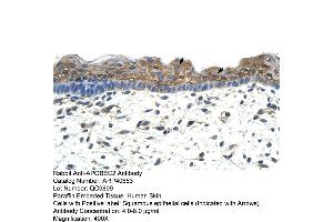 Rabbit Anti-APOBEC2 Antibody  Paraffin Embedded Tissue: Human Skin Cellular Data: Squamous epithelial cells Antibody Concentration: 4. (APOBEC2 抗体  (N-Term))