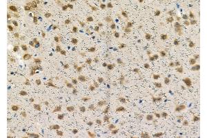 ABIN6257543 and ABIN6274338 at 1/100 staining Rat brain tissue by IHC-P. (TCOF1 抗体  (N-Term))
