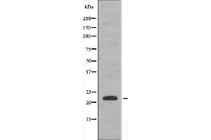 Western blot analysis of extracts from HeLa cells using CBF β antibody. (CBFB 抗体  (N-Term))