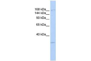 WB Suggested Anti-UTX Antibody Titration: 0. (KDM6A 抗体  (Middle Region))