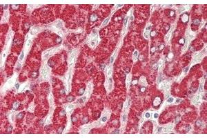 Detection of GBA in Human Liver Tissue using Polyclonal Antibody to Glucocerebrosidase (GBA) (GBA 抗体  (AA 117-214))