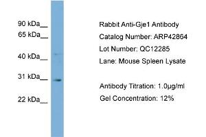 WB Suggested Anti-Gje1 Antibody Titration:  0. (GJE1 抗体  (N-Term))