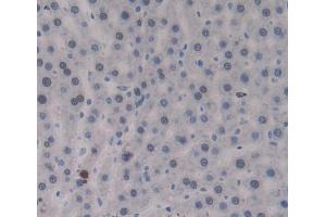 IHC-P analysis of Kidney tissue, with DAB staining. (PTPRJ 抗体  (AA 1033-1277))