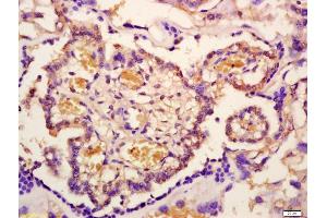 Formalin-fixed and paraffin embedded mouse placenta labeled with Anti-Phospho-IRAK1(Thr209) Polyclonal Antibody, Unconjugated (ABIN1385694) at 1:200 followed by conjugation to the secondary antibody and DAB staining (IRAK1 抗体  (pThr209))