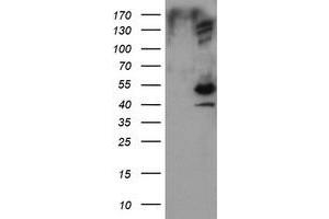 Image no. 1 for anti-DIX Domain Containing 1 (DIXDC1) antibody (ABIN1497840) (DIXDC1 抗体)