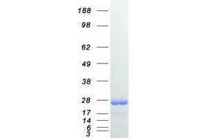 RAB7A Protein (Myc-DYKDDDDK Tag)