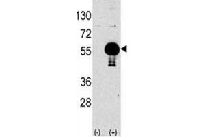 Western blot analysis of AKT2 antibody and 293 lysate transiently transfected with the human gene (2ug/lane).