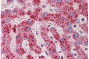 Human Liver: Formalin-Fixed, Paraffin-Embedded (FFPE) (14-3-3 zeta 抗体  (C-Term))