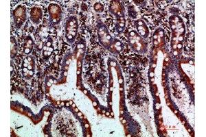 Immunohistochemical analysis of paraffin-embedded human-small-intestine, antibody was diluted at 1:200 (BTLA 抗体  (AA 101-150))