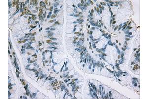 Immunohistochemical staining of paraffin-embedded liver using anti-EpCAM (ABIN2452541) mouse monoclonal antibody. (EpCAM 抗体  (AA 24-265))