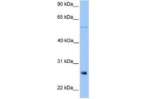 METTL7B antibody used at 1 ug/ml to detect target protein. (METTL7B 抗体  (Middle Region))