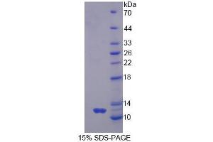 SDS-PAGE analysis of Human GNg2 Protein. (GNG2 蛋白)