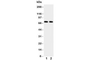 Western blot testing of Prolactin Receptor antibody and Lane 1:  HeLa