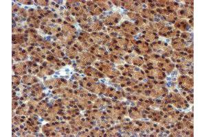 Image no. 3 for anti-Mannose Phosphate Isomerase (MPI) antibody (ABIN1499545) (MPI 抗体)