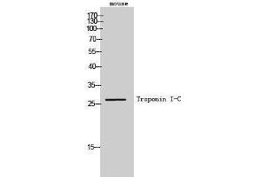 Western Blotting (WB) image for anti-Cardiac Troponin C (TNNC1) antibody (ABIN3180933) (TNNC1 抗体)