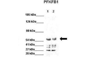 WB Suggested Anti-PFKFB1 Antibody  Positive Control: Lane 1: 40ug HEK293 lysate Lane 2: 40ug H1299 lysate  Primary Antibody Dilution :  1:1000 Secondary Antibody : Goat anti-rabbit-HRP  Secondry Antibody Dilution :  1:5000 Submitted by: Jose Luis Rosa, Universitat de Barcelona (PFKFB1 抗体  (C-Term))