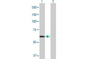 Western Blot analysis of ACCS expression in transfected 293T cell line by ACCS MaxPab polyclonal antibody. (PHACS 抗体  (AA 1-501))