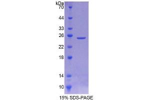 SDS-PAGE analysis of Rat SIAL2 Protein. (Sialidase 2, Cytosolic 蛋白)