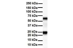 Western Blotting (WB) image for anti-Solute Carrier Family 33 Member 1 (SLC33A1) (Middle Region) antibody (ABIN2781611)