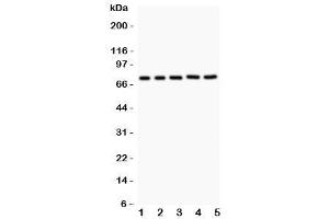 Western blot testing of RIP1 antibody and Lane 1:  Jurkat (RIPK1 抗体  (AA 316-671))