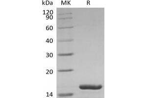 Western Blotting (WB) image for Interleukin 1 Family, Member 6 (IL1F6) (Active) protein (ABIN7319787) (IL36A/IL1F6 蛋白)