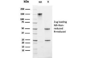 SDS-PAGE (SDS) image for anti-Antigen Identified By Monoclonal Antibody Ki-67 (MKI67) (AA 2293-2478) antibody (ABIN6940052)