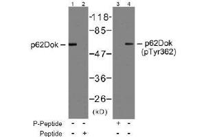 Image no. 2 for anti-Docking Protein 1, 62kDa (Downstream of tyrosine Kinase 1) (DOK1) (AA 360-364) antibody (ABIN197537) (DOK1 抗体  (AA 360-364))