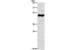 Western blot analysis of Mouse pancreas tissue, using ILK Polyclonal Antibody at dilution of 1:550 (ILK 抗体)