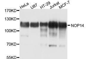 Western blot analysis of extracts of various cell lines, using NOP14 antibody. (Nop14 抗体)