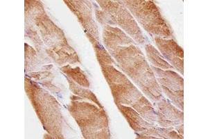 Immunohistochemical analysis of paraffin-embedded mouse skeletal muscle using Musk antibody at 1:25 dilution. (MUSK 抗体)