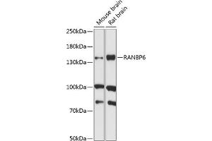 Western blot analysis of extracts of various cell lines, using R antibody (ABIN7269845) at 1:1000 dilution. (RANBP6 抗体  (AA 1-70))
