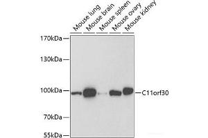 Western blot analysis of extracts of various cell lines using C11orf30 Polyclonal Antibody at dilution of 1:1000. (EMSY 抗体)