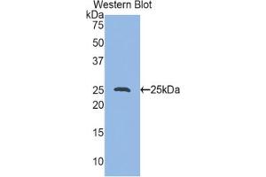 Western blot analysis of the recombinant protein. (HSP27 抗体  (AA 1-209))