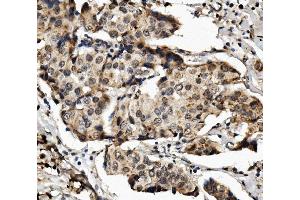 IHC analysis of MED4 using anti-MED4 antibody (ABIN7600817).