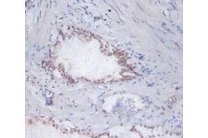 Immunohistochemistry of paraffin-embedded human prostate tissue using ABIN7150599 at dilution of 1:100 (DAD1 抗体  (AA 1-113))