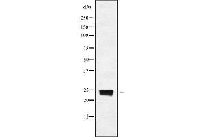 Western blot analysis of RAB8A using COS7 whole cell lysates (RAB8A 抗体)