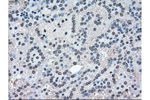 Image no. 6 for anti-Mitogen-Activated Protein Kinase 1 (MAPK1) antibody (ABIN1499291)