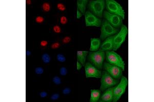 ABIN6256450 and ABIN6267096 staining Heat-shock treated Hela cells by IF/ICC. (BCL9L 抗体  (pSer915))