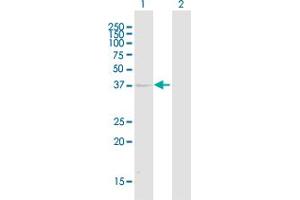Western Blotting (WB) image for anti-Killer Cell Immunoglobulin-Like Receptor, Two Domains, Long Cytoplasmic Tail, 1 (KIR2DL1) (AA 1-374) antibody (ABIN2752286)