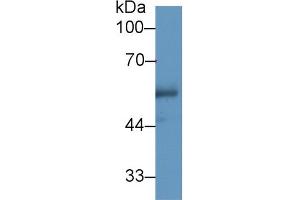 Western Blot; Sample: Human Urine; Primary Ab: 1µg/ml Rabbit Anti-Human CETP Antibody Second Ab: 0. (CETP 抗体  (AA 353-443))