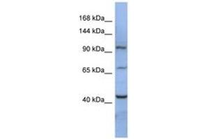 Image no. 1 for anti-RNA Binding Motif Protein 12 (RBM12) (AA 107-156) antibody (ABIN6742995) (RBM12 抗体  (AA 107-156))