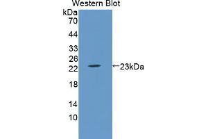 Western blot analysis of the recombinant protein. (LCN5 抗体  (AA 28-187))