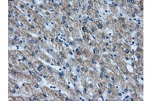 Immunohistochemical staining of paraffin-embedded liver tissue using anti-AKR1A1mouse monoclonal antibody. (AKR1A1 抗体)