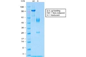 SDS-PAGE Analysis of Purified WT1 Rabbit Recombinant Monoclonal Antibody ABIN6383831.