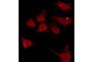 ABIN6276185 staining Hela by IF/ICC. (OR7A10 抗体  (C-Term))